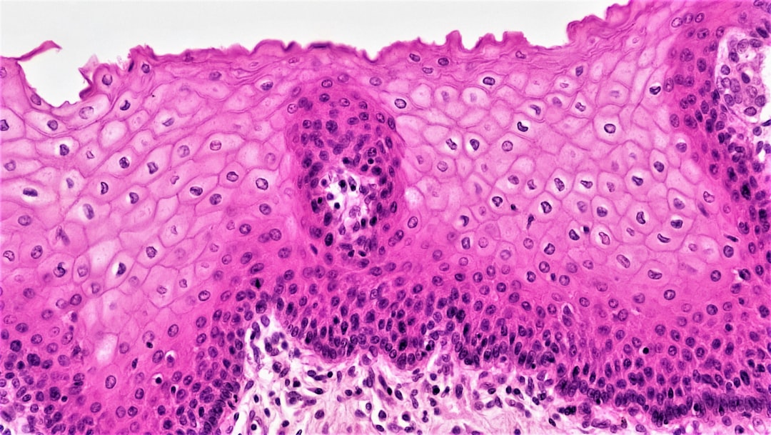 Photo Gastric Cancer Diagnosis